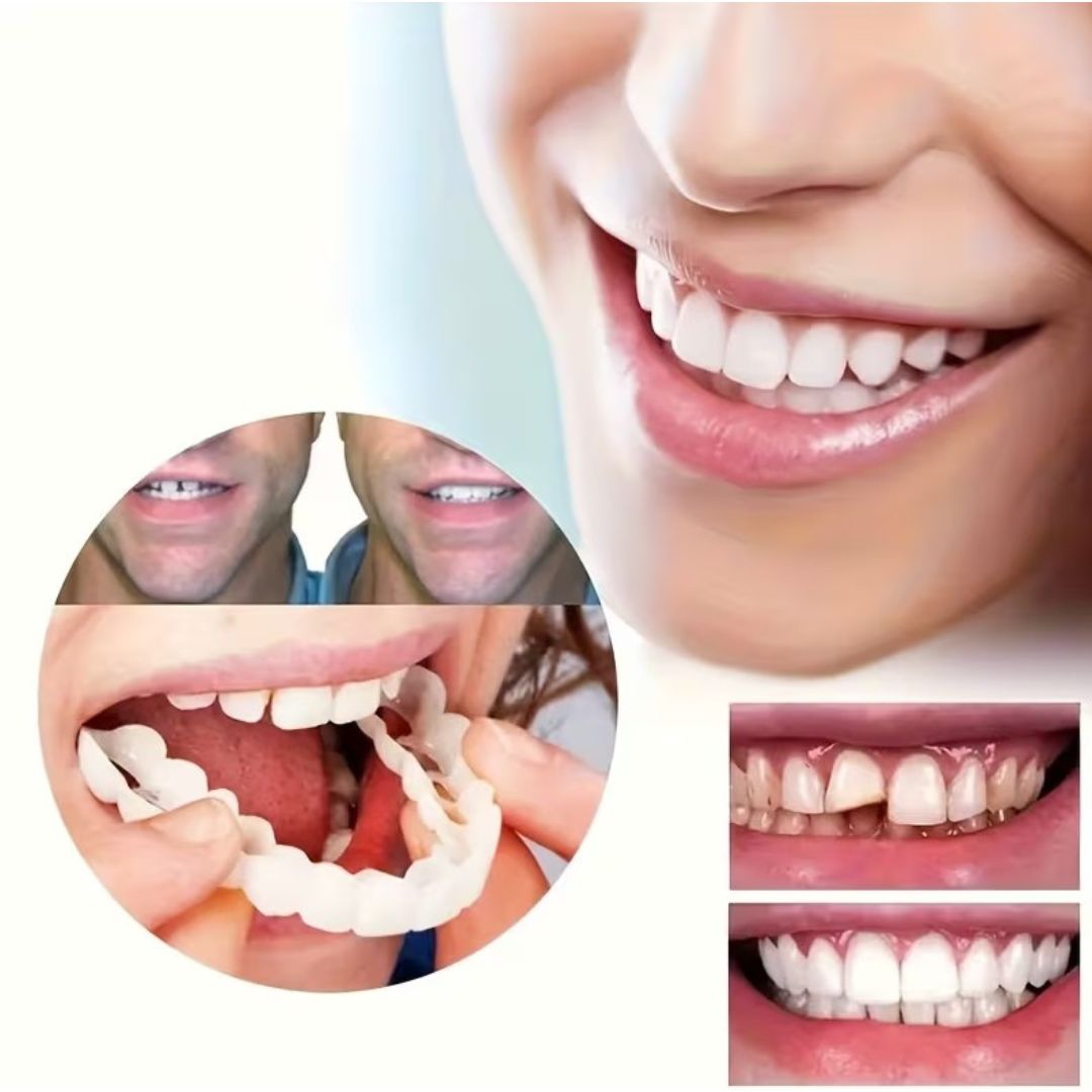 True Smile-универсални фасети